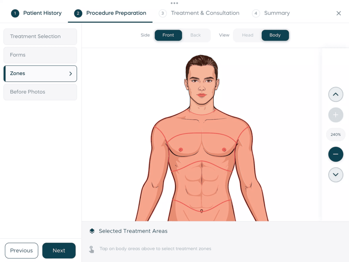 Procedure preparation